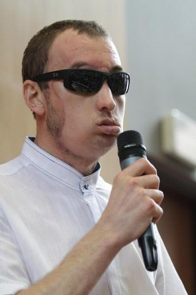 Gliwice kentindeki Onkoloji Merkezi'nde yapılan nakil, hem Polonya i&ccedil;in hem de d&uuml;nya i&ccedil;in olduk&ccedil;a &ouml;nemli bir operasyon niteğinde.