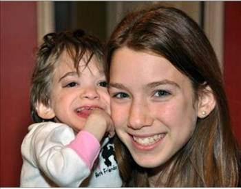 D&Ouml;RT YAŞINDA KALDI  17 yaşındaki kız &ccedil;ocuğu Brooke&rsquo;un d&ouml;rt yaşından beri sadece sa&ccedil;ları ve tırnakları uzuyor. B&uuml;y&uuml;me hormonu kesinlikle etki etmiyor ve bilim adamları uzun s&uuml;reden bu hastalığa &ccedil;are bulmaya &ccedil;alışıyor. Ailesi ise artık Brooke&rsquo;un bir bebek gibi olduğunu kabul etmiş durumda.