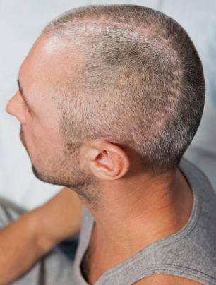 7 metreden kafa &uuml;st&uuml; &ccedil;akışan 32 yaşındaki Charlie&rsquo;yi otel g&ouml;revlileri acilen adadaki hastaneye g&ouml;t&uuml;rd&uuml;. Oradan daha b&uuml;y&uuml;k bir hastaneye sevk edilen Charlie ameliyat edildi. 