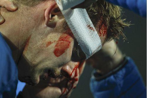 Slovak savunma oyuncusu, kanlar içindeki görüntüsü ile futbolseverleri korkuttu.