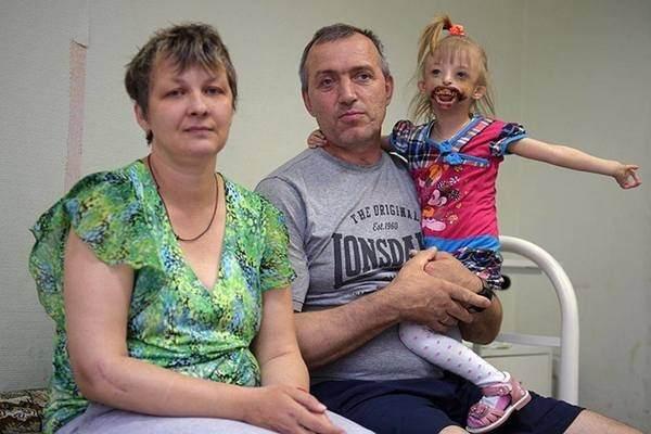 <p>Helena eşinin verdiği tepkiyle daha iyi hissetti. Çocuk ve anne taburcu edildi. Doktorların söylediklerinin aksine Darina günden güne güçlenmeye başladı. Kızı gören insanlar, aileye ön yargılı bakışlar atıyorlardı. </p>