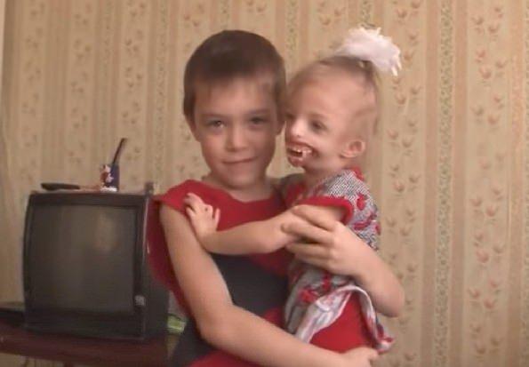 <p>Küçük kız daha önce operasyon geçirmişti ancak daha fazla operasyona ihtiyacı vardı. Helena ve Juri, kızlarının diğer çocuklar gibi bir hayatı olmasını istiyordu.<br />
</p>