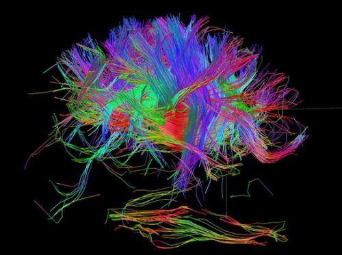 <p>Amerikalı bilimadamları, beyin yapılarının kişiliği ve yetenekleri nasıl belirlediğinin anlaşılmasına yönelik uluslararası proje kapsamında ayrıntılı beyin görüntülerini inceleyebildi.</p>
