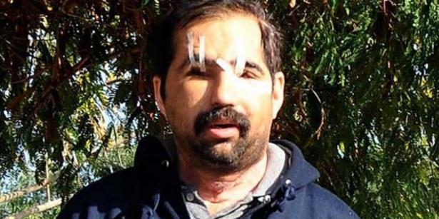 <p>4 Temmuz – Türkiye’nin 6. yüz nakli Salih Üslün hayatını kaybetti </p>

<p> </p>
