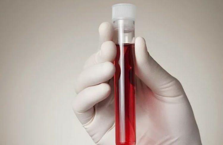 <p>1. Türk bilim insanlarından, her kan grubuyla uyuşan yapay kan </p>

<p> </p>
