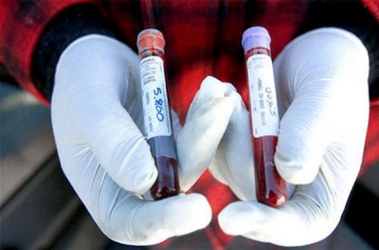 <p>Bağışlanan kanlar maalesef bir ay muhafaza edildikten sonra bozuluyor. Yapay kan ise bir yıl boyunca bozulmadan saklanabiliyor.</p>

<p> </p>
