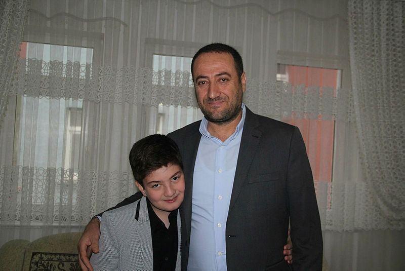 <p>Yürüme yeteneğinin kaybından sonra karşılaşılan en önemli sorunlar eklemlerde bozulma ve omurgada eğilme yani skolyozdur. Kollar, bacaklar ve gövde kasları dışında solunum kasları da zayıflar ve buna bağlı olarak çocuklar sık akciğer enfeksiyonuna yakalanır. Ayrıca kalp kaslarında da tutulum gözlenebilir. Hastalığın ilerleyişi ile ortalama 20 yaş civarında hastalar kaybedilirler.</p>

<p> </p>
