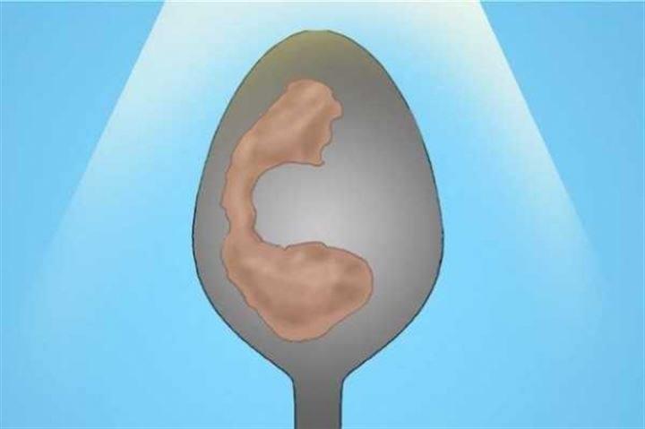 <p>1 dakika sonra kaşığı poşetten çıkarın ve üstünde bir leke olup olmadığına dikkatlice bakın. Üstünde herhangi bir leke görülmüyorsa ve kaşığın kokusu ağız kokunuza benzer ise sağlığınızda bir problem yok diyebiliriz. </p>
