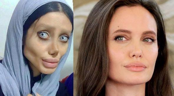<p>İranlı genç kız, Angelina Jolie'ye benzemek için bir servet harcadı. Üst üste estetik operasyonlar geçiren kızın son hali görenleri şaşkına çeviriyor.</p>

<p> </p>
