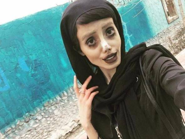 <p>Ardından üst üste estetik operasyonlar geçiren İranlı kadının son halini gören Instagram kullanıcıları ‘İnsanlıktan çıkmış' yorumları yaptı.</p>

<p> </p>
