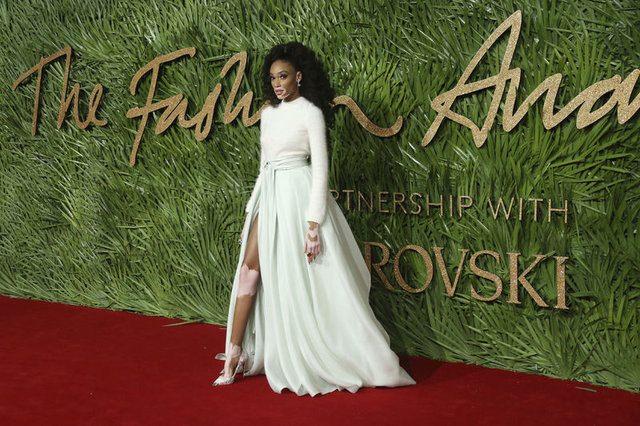 <p>Winnie Harlow</p>

