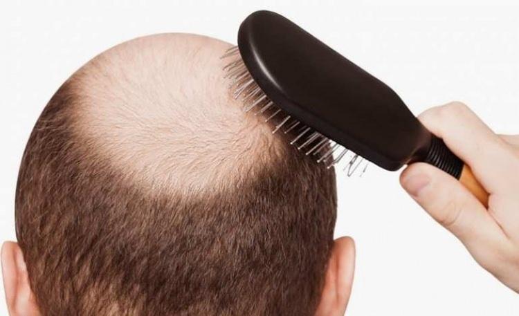 <p><strong>BİRÇOK FAYDASI VARDIR</strong></p>

<p>Soğan, özellikle sülfür gibi, saçların uzamasına yardımcı birçok faydalı içeriğe sahiptir.</p>
