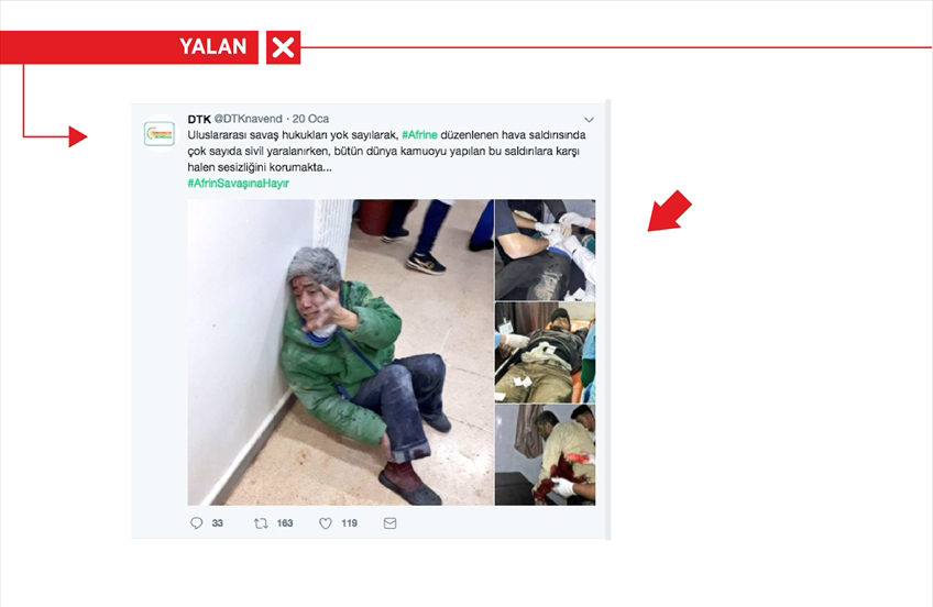 <p>Örgüte yakın hesaplar, PYD/PKK'nın sivillere yaptığı saldırıları da yalanlarına alet etmekten çekinmedi. PYD/PKK'nın 19 Ocak 2018'de Afrin'den Türkiye sınırında yer alan Azez ilçesindeki 2 hastaneye yaptığı saldırı, sosyal medyaya "TSK'nin Afrin'de sivilleri hedef aldığı" iddiasıyla servis edildi.</p>
