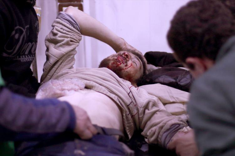 <p>İngiltere merkezli Suriye İnsan Hakları Gözlemevi Esed rejimi tarafından gerçekleştirilen bombardımanda 24 saat içinde aralarında çocukların da bulunduğu en az 167 kişinin öldüğünü duyurdu. Esed Rejimi ise Doğu Guta’da sivillerin hedef alınmadığını ileri sürdü.</p>
