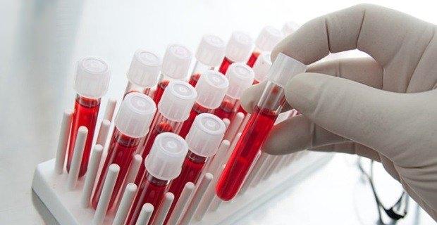 <p><strong>Hangi belirtileri gösterir?</strong></p>
<p>- Boğaz ağrısı</p>
<p>- İdrar yolu enfeksiyonu</p>
<p>- Ağız içerisindeki beyaz leke ve yaralar</p>