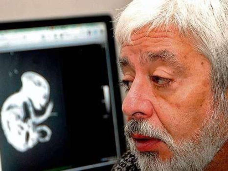 <p>Etobur bir hayvanın diş yapısına sahip bu yaratığın; aynı zamanda kafatası yapısı itibariyle de diğer hayvanlara göre daha yüksek zeka seviyesine sahip olduğu düşünülüyor. Diş yapısı, kertenkeleye benzeyen yaratık; eklem ve iç kulakları yapısıyla da insana benzediği iddia ediliyor.</p>
