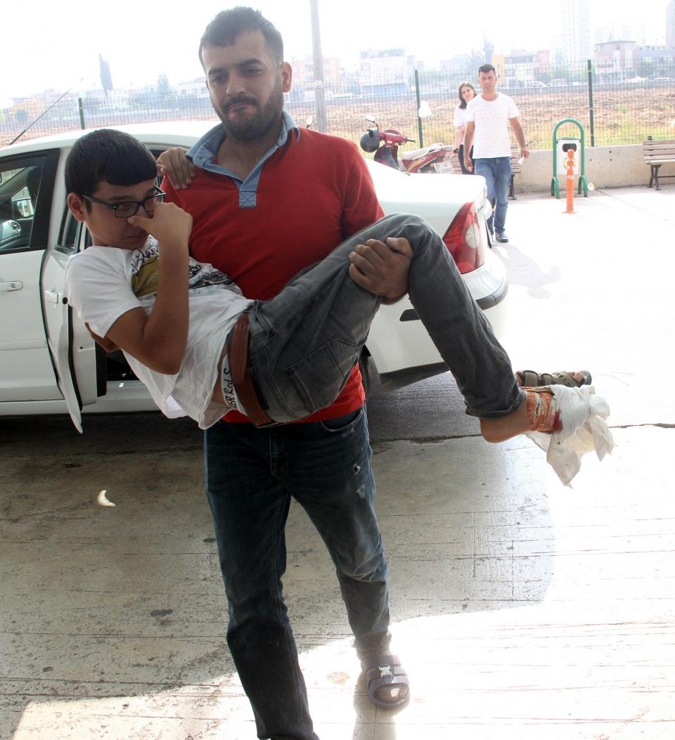 <p>Adana'da Kurban Bayramının ilk günü kurban kesmek isterken kendini yaralayan acemi kasaplar hastanelere akın ederken, 11 yaşındaki bir çocuk da ayağını keserek yaralandı </p>
