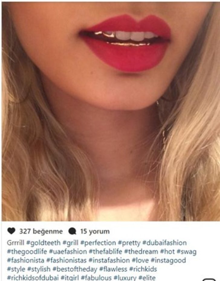 <p> Dişler, beyaz veya altın gibi parlıyor </p>
<p> </p>
