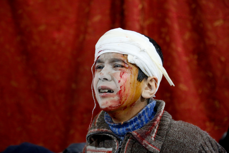 <p><strong>Suriye’nin çocukları </strong></p>

<p>Suriye'deki Beşşar Esed rejiminin, abluka altında tuttuğu Doğu Guta bölgesine düzenlediği saldırılarda yaralanan bir çocuk, sahra hastanesine nakledilerek tedavi altına alındı.   </p>

<p>Khaled Akasha  </p>
