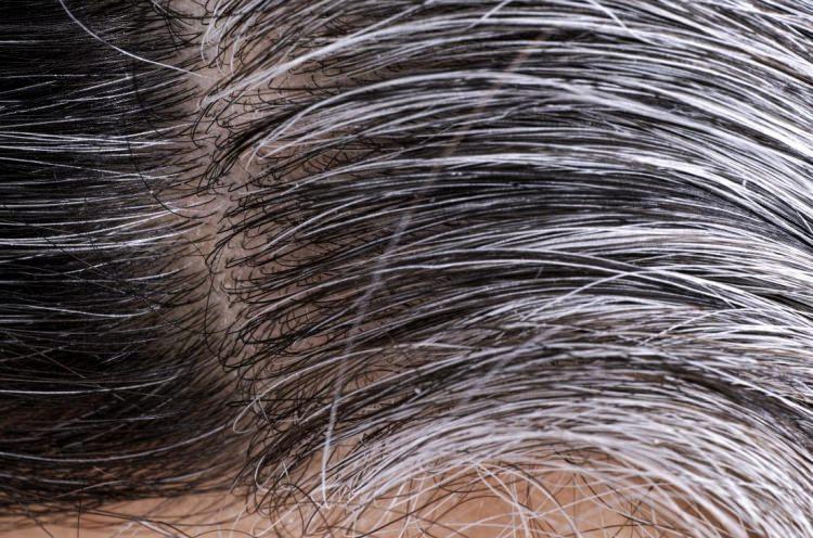 <p><span style="color:#FFA07A"><strong>Saçların beyazlaması, yaşlanma ile birlikte görülen doğal bir süreçtir. Saçların renginden sorumlu olan pigment, saç kökündeki bir hücreden gelir. Bu hücreler önemli miktarlarda melanin (koyu pigment) üretilmesi için genetik olarak kodlanır. Zamanla melanin üretim kapasitesi azalır. Melanin üretim kapasitesi ve melanin miktarındaki azalma da saçlarda beyazlamaya neden olur. Bu durumda kişiler birbirinden farklı yöntemlere başvurarak saçların beyazlarını kapatabilir. </strong></span></p>

