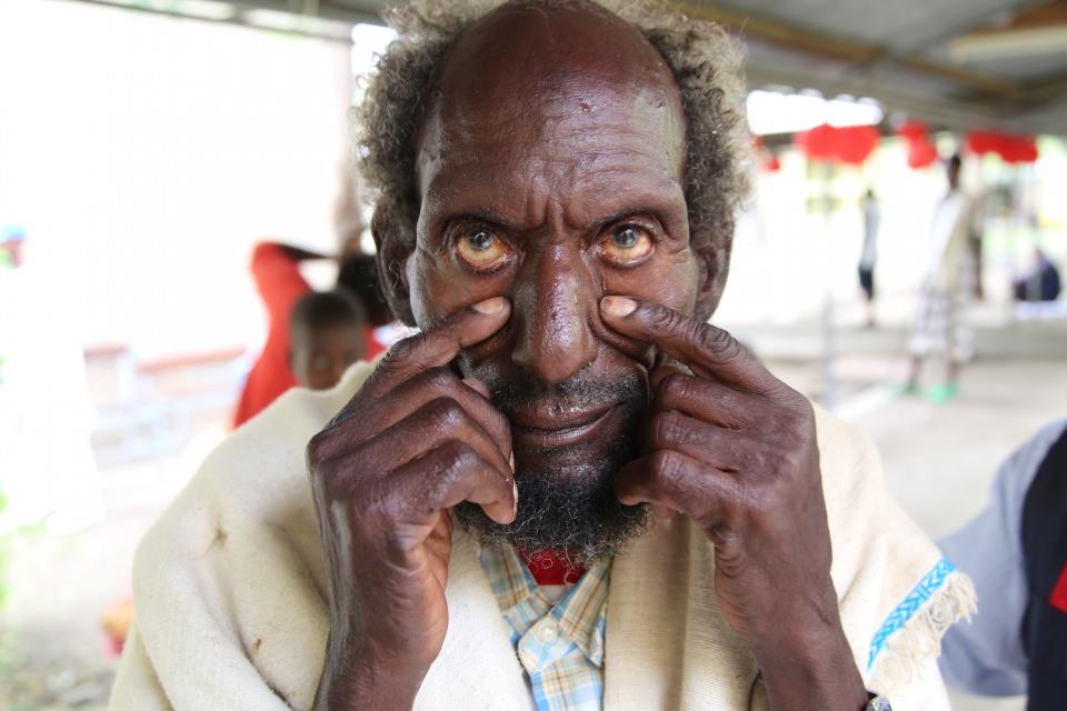 <p>Şanlıurfa Sivil Toplum Kuruluşları İnsani Yardım Platformu ile Deniz Feneri Derneği bir süre önce Etiyopya'daki imkansızlıklar nedeniyle katarakt ameliyatı olamayanlar için çalışma başlattı. Çalışmalar kapsamında Afar eyaletinin kırsal bölgelerinde yaşayan ve katarakt nedeniyle gözleri görmeyen 100 kişi, bölgedeki tek sağlık kuruluşu olan Macamad Oakleh Kassehta Hastanesi'nde ameliyat ettirildi.</p>

<p> </p>
