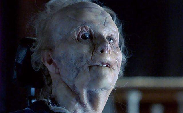 <p>Mason Verger (Hannibal)</p>

<p> </p>
