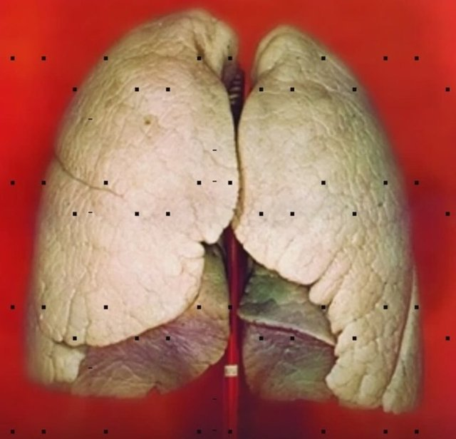 <p>Akciğer</p>

<p> </p>
