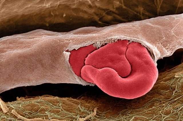 <p>Bu da v&uuml;cudumuzun i&ccedil;inden &ccedil;ekilen bir kare...</p>

<p>&nbsp;</p>
