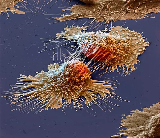 <p><strong>Tek bakışta anlam veremediğimiz bazı fotoğraflar vardır. Bu ilginç görüntülere iki kere bakmanız gerekecek. İşte kafa karıştıran ilginç o kareler...</strong></p>

<p><strong>Bir kanser hücresinin elektron mikroskobu altındaki görüntüsü.</strong></p>

<p> </p>
