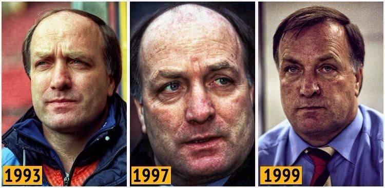 <p>90'larda Dick Advocaat</p>
