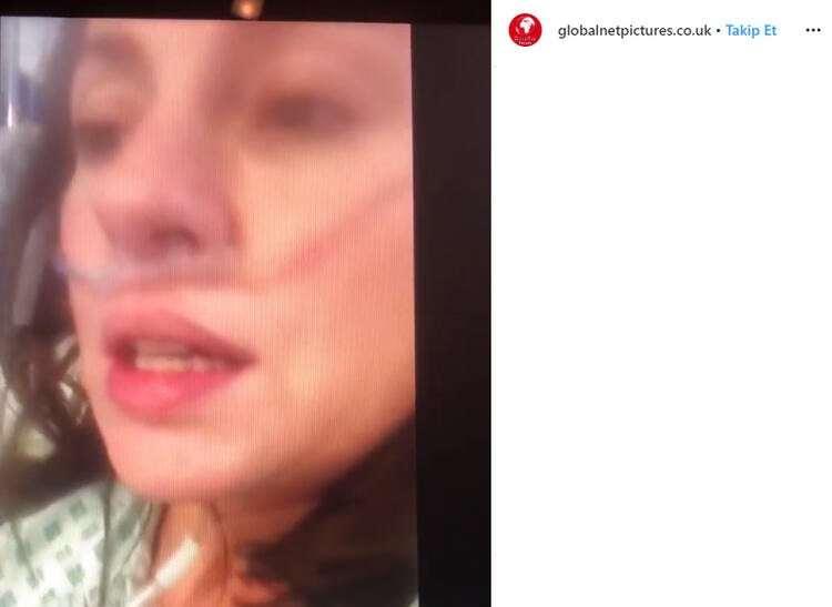 <p>Çektiği videoda corona virüsün tehlikeleri konusunda insanları uyarırken nefes almak için mücadele eden kadın, 'Ciğerlerimde cam varmış gibi hissediyorum' ifadelerini kullanıyor.</p>
<p> </p>