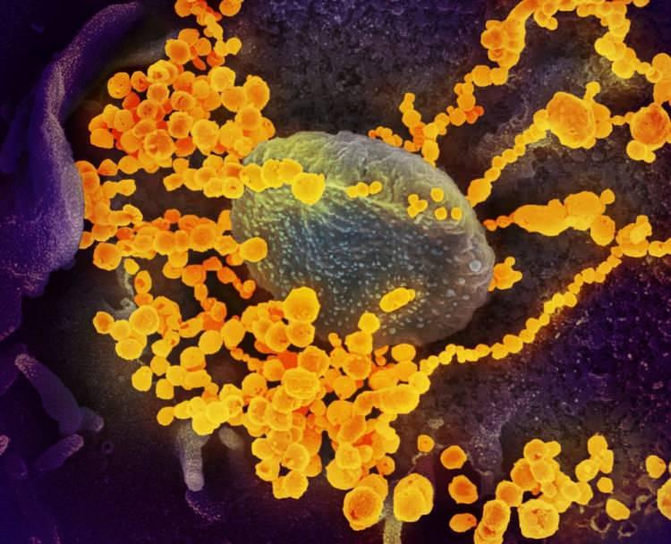 <p>ABD’de yapılan bir çalışmada, yeni tip corona virüsün (Covid-19) insan hücrelerindeki yayılışı elektron mikroskobuyla görüntülendi. ABD’li bir hastadan alınan Covid-19’la enfekte olan hücreler laboratuvar ortamında çoğaltılarak virüsün en net görüntüleri kaydedildi.</p>
