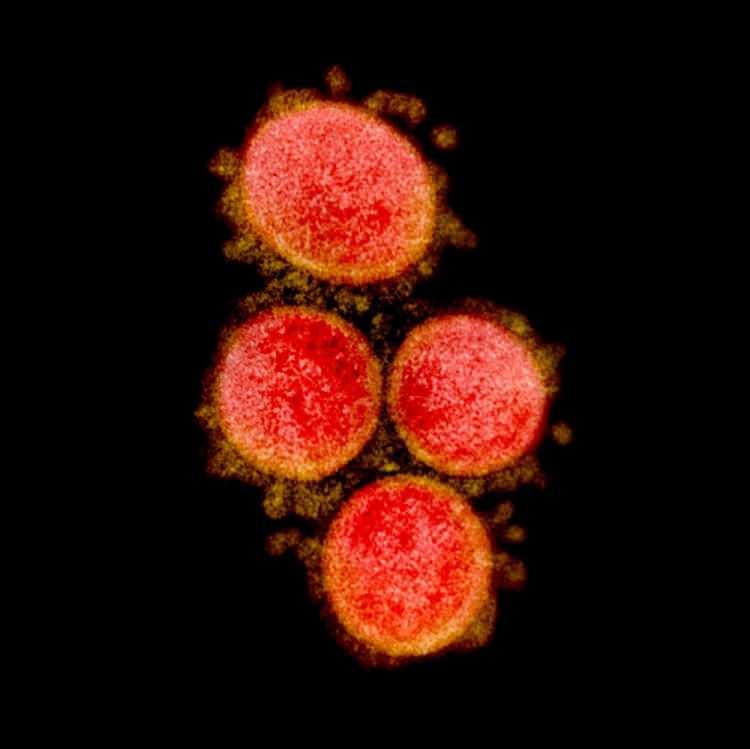 <p>CORONA VİRÜSÜN EN NET GÖRÜNTÜLERİ<br />
Medikal görselleştirme uzmanları, virüsü sağlıklı hücrelerden ayırmak için renklendirdi. Yapılan çalışmada corona virüsün insan hücrelerinde yarattığı tahribat tüm yönleriyle açığa çıkarıldı.</p>
