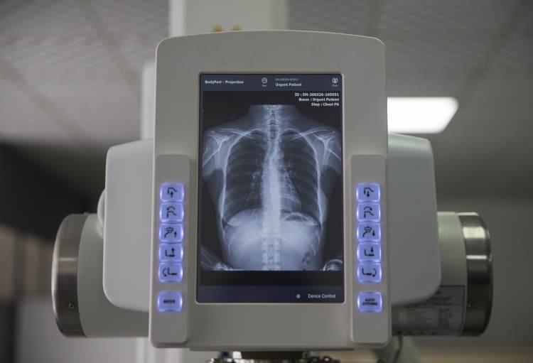 <p>Bugüne kadar farklı tiplerde, mobil dijital ve analog röntgen sistemleri ürettiklerini belirten Demirel, "Dünyada sayılı firma tarafından üretilen yüksek frekanslı x-ray jeneratörlerini üretmeyi başardık. Şu anda sertifikasyon sürecindeyiz. Salgın dolayısıyla sertifikasyonumuz 1-2 ay ötelendi. Sertifikasyon işlemi tamamlandıktan sonra yılda 100-150 adet kapasiteyle seri üretime başlayacağız." dedi.</p>