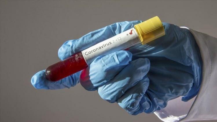 <p>Ülkemizde görülen koronavirüsü kapsamında vaka sayıları günlük olarak açıklanıyor. Sağlık Bakanlığı corona virüs canlı verileri kamuoyuyla paylaşmaya devam ediyor.<br />
<br />
<span style="color:#FF8C00"><strong>İŞTE GÜN GÜN KORONAVİRÜS TABLOSU</strong></span></p>

