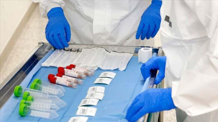 Bilim insanları acı gerçeği yüzümüze vurdu: Salgının asıl sebebi! Acilen durdurun