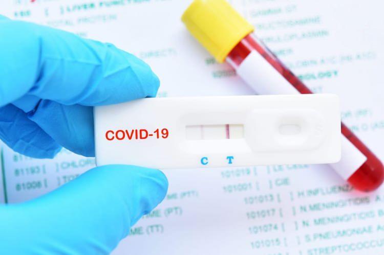 Dakikalar içinde sonuç veren ilk koronavirüs antijen testine onay