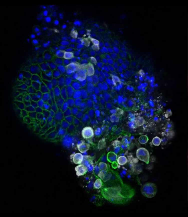 <p>Ultra güçlü bir mikroskopla  görüntülenen insan bağırsağının bir doku modelinde Sars-CoV-2 (Yeni tip corona virüs) parçacıklarının yayılımını görülüyor. </p>
