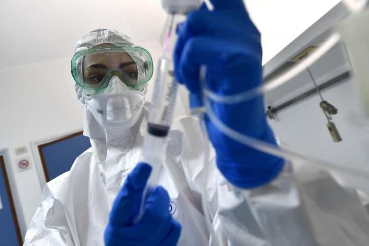 <p>Uzmanlar yapılan keşfin, Covid-19 hastalarının yaklaşık üçte birinin neden diyare gibi gastrointestinal semptomlar yaşadığını açıkladığını ve virüsün dışkı örneklerinde de tespit edilebileceğini gösterdiğini söyledi.</p>
