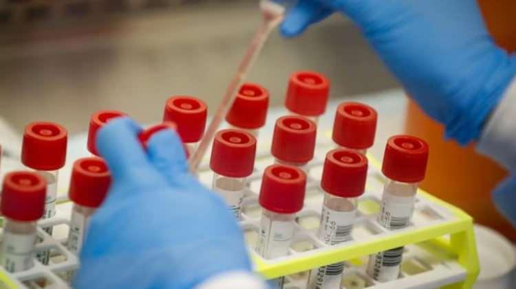 <p>İnsan bağırsağına ait hücre kültürü modellerini kullanan araştırmacılar, virüsü test tüplerinde başarıyla büyüttüler ve bağırsak hücrelerinin virüse tepkisini izlediler.</p>
<p> </p>