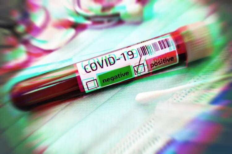 İngilizler Kovid-19'a karşı yeni bir tedavi yöntemi buldu! İlk sonuçlar çok olumlu