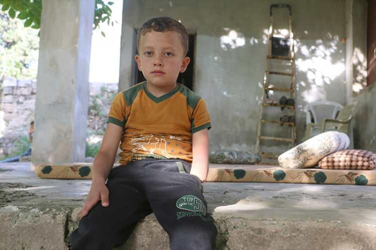<p>Beşşar Esed rejiminin İdlib'deki bombardımanlarında yaralanarak ağır bedeller ödeyen Suriyeli çocuklar, savaşın silinmeyen acı izleriyle yarınlarını bilemeden büyüyor. </p>

<p> </p>
