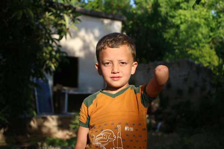 <p>8 yaşındaki İdlibli Abdürrahman Davut, 5 yıl önce rejimin düzenlediği bir hava saldırısında babasını kaybederken, şarapnel parçası da sol koluna saplandı. Küçük yaşta ampute olan Davud, yaşadığı o acılı anları hafızasından silemiyor.</p>
