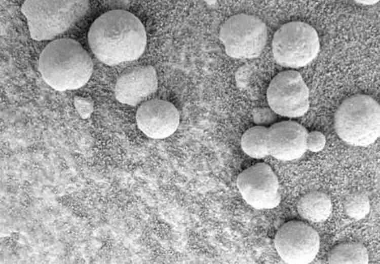 <p>Mars'ta topun ne işi var?<br />
<br />
Fotoğraftaki obje ilk bakışta Ortaçağ’da kullanılan gülleleri hatırlatıyor. Beynimiz, fotoğraftaki nesnenin insan yapımı (Ya da belki de uzaylı yapımı!) bir top olduğunu bize söylese de, muhtemelen bu yalnızca, inanılmaz aşamalardan geçerek oluşmuş normal bir kaya.</p>