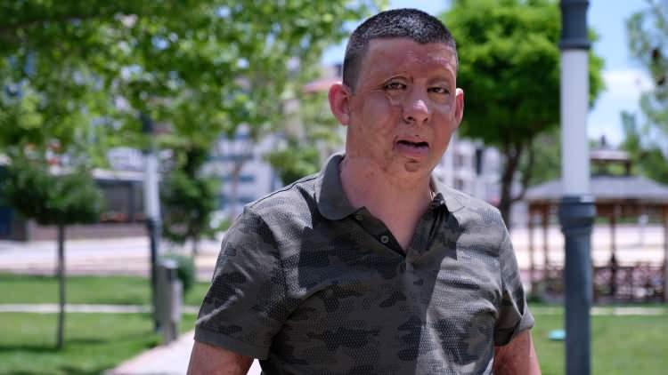Cumhurbaşkanı Erdoğan'ın talimatıyla hayatı değişti