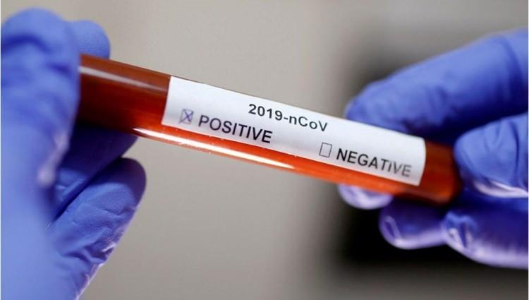 Koronavirüs ikinci dalga ihtimalinin en yüksek olduğu 10 ülke açıklandı