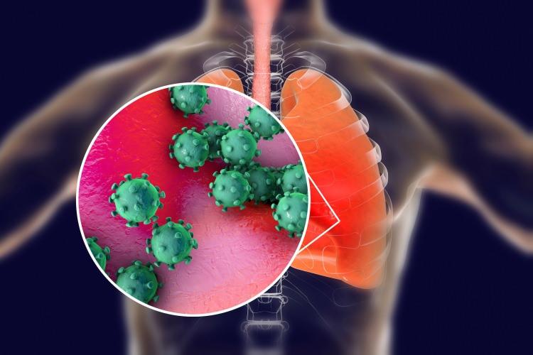 <p> Richard Marsden, şirketin kronik bronşit ve amfizem hastalarına yardımcı olmak için interferon beta ilacını kullanan bir klinik deneye dahil olduklarını ve koronavirüs salgını ortaya çıktığında, bu virüse karşı savunmada önemli bir rol oynayabileceklerini fark ettiklerini ifade etti.</p>