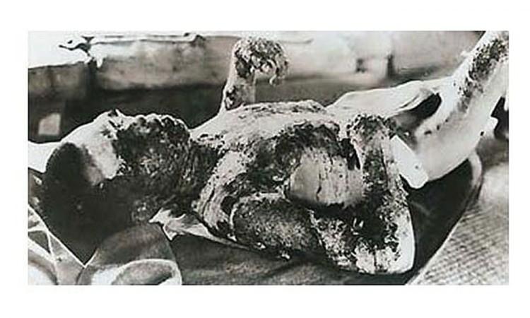 <p>Hiroşima’daki saldırıdan sadece 3 gün sonra 9 Ağustos 1945’te Nagasaki’de Plütonyum -239 tipi atom bombası ‘’Fat Man’’ (Şişko Adam) ile ikinci saldırı gerçekleştirildi.</p>

<p> </p>
