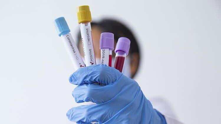 <p>Klinik denemelerin ilk aşamasında, az sayıdaki gönüllü sağlıklı denek üzerinde aşının güvenli olup olmadığı ve olası yan etkileri araştırılıyor.</p>
