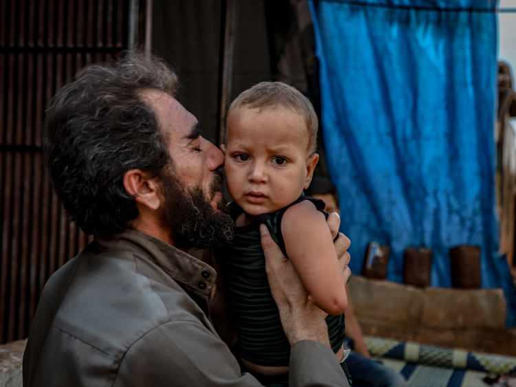 <p>Hayat şartlarının oldukça zor olduğu sığınmacı kampına yerleşen Esyef bebeğin babası Muhammed Ablo'nun en büyük isteği ise çocuğunun protez takılarak da olsa yürüdüğünü görebilmek.</p>

<p> </p>
